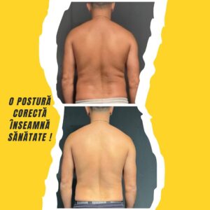 Acces Program Sport Therapy